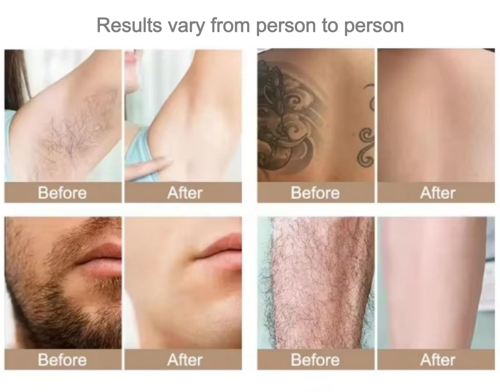 Dispositivo di bellezza 2 in 1 la rimozione dei peli e delle imperfezioni | Dispositivo professionale per l'epilazione permanente indolore, adatto sia a uomini che a donne