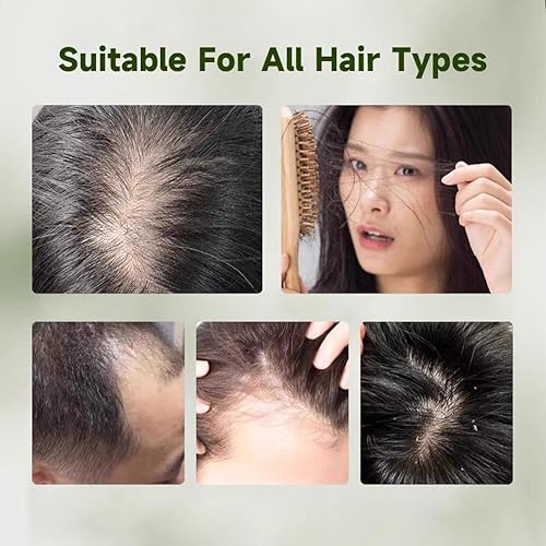 Miniatura 5 de Nature Triangle - Barra de champú natural, jabón sólido a base de plantas, hecho a mano, hojas de ciprés verde, barra de jabón a base de hierbas,