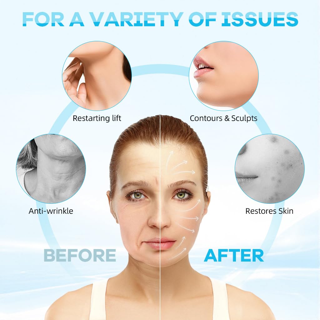 MAYCREATE® Double Chin Reducer Face Lifting Mask Device Cool Touch V-Line Jawline Shaper Breathable Double Chin Lift Mask Strap Belt for Sleeping Anti-Wrinkle Full-Face Lifting 2