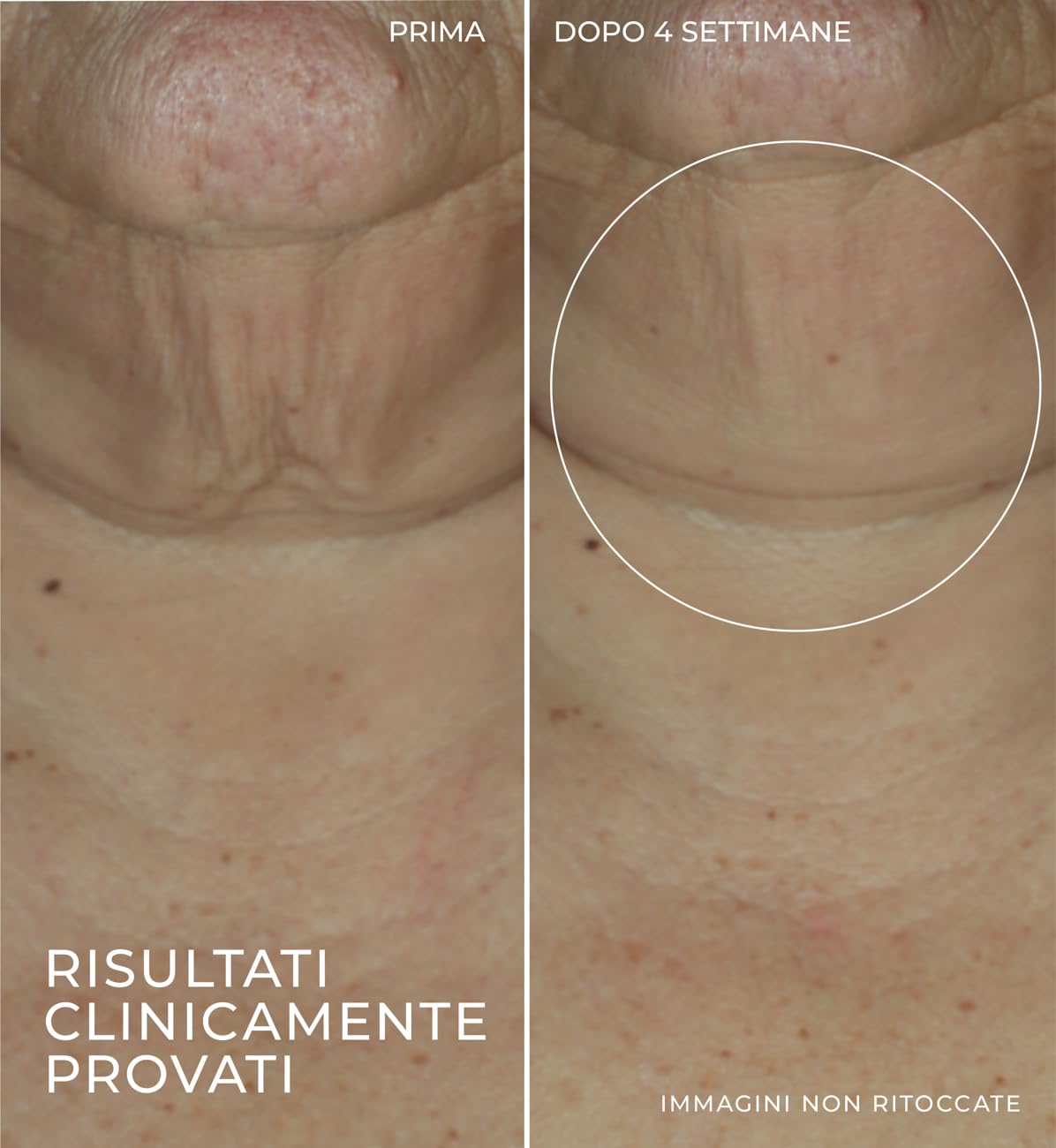 RoC DERM CORREXION FIRMING SERUM STICK