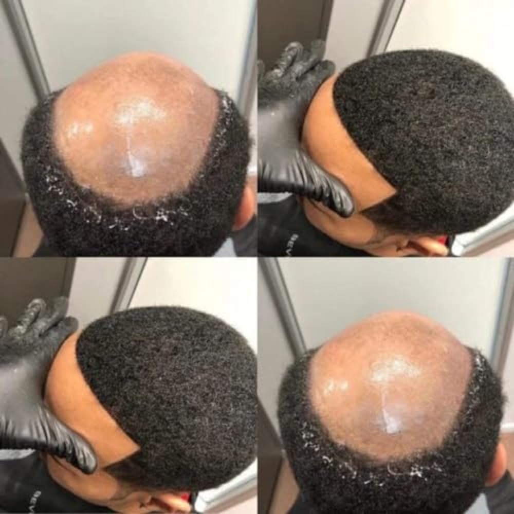 Afro Toupee for Black African Men - Men's Weave, Curly Kinky Afro Hair Replacement Unit, Black Men Wig, African American Hair Toppers - Image 4