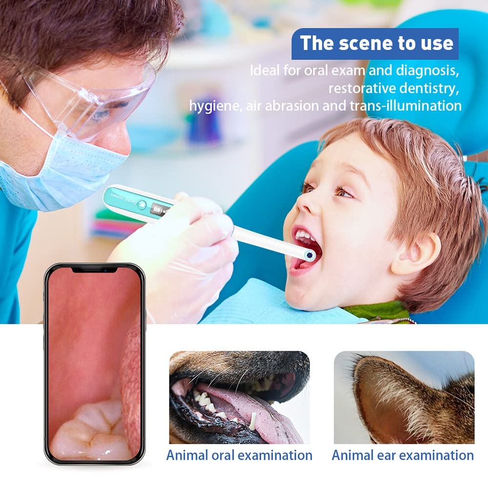 Telecamera Orale Dentale, Endoscopio Intraorale Wireless Endoscopio Orale 8 Rilevatore Impermeabile LED Regolabile Bocca Dentale per iOS/Androide/Tablet