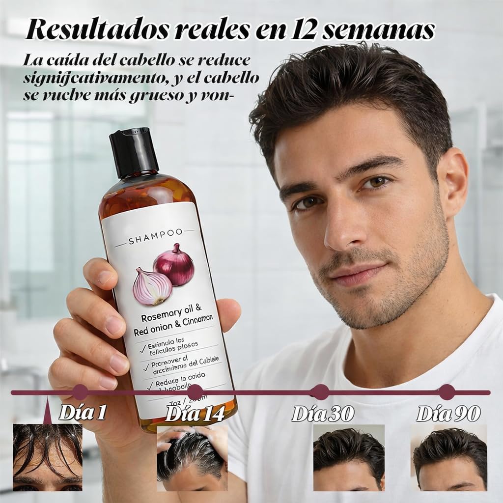 Excalvo Champu De Cebolla,2026 Nuevo Champu Cebolla,Champu Excalvo,Limpieza Diaria Para Un Cabello Más Denso En Apariencia,Para Hombres Y Mujeres,236ml (1) — view 3