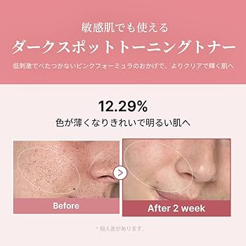 Pinky　トナーf １本 Amazon | メディキューブ PDRN ピンクトナー 化粧水 サーモン注射 低