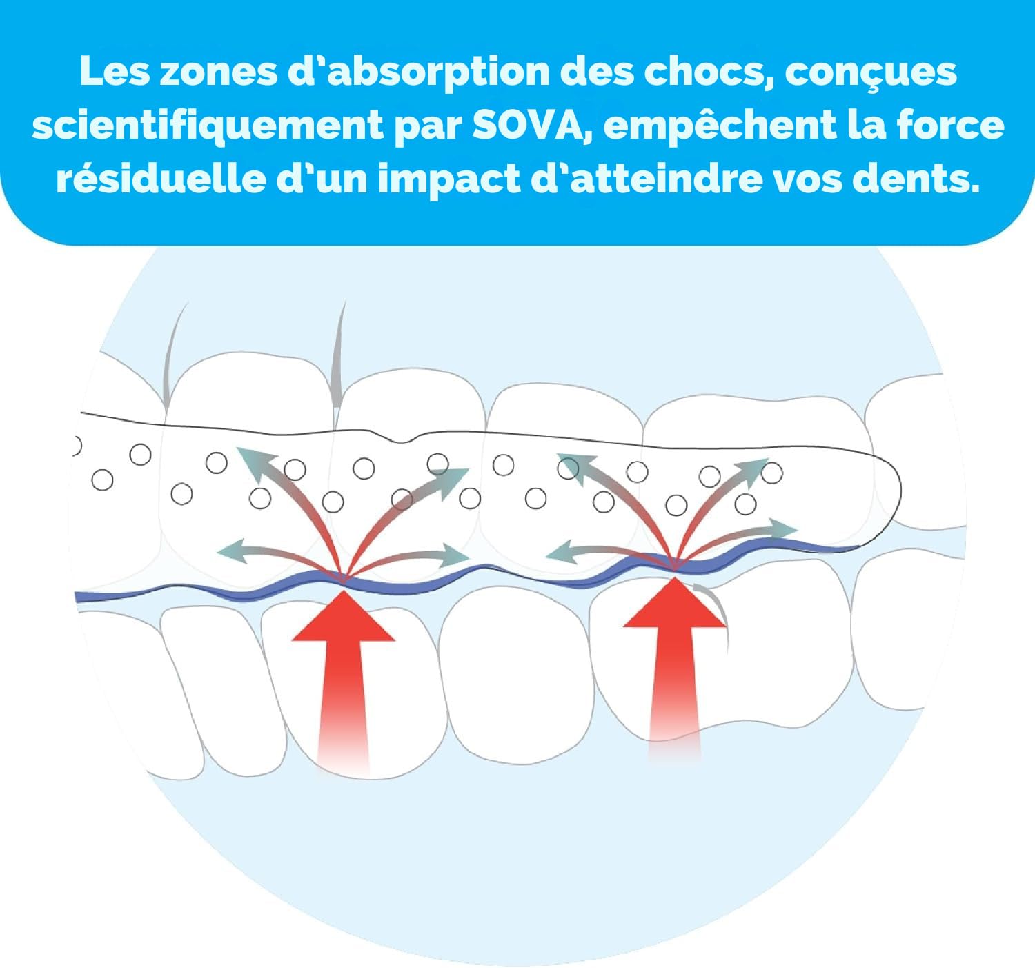 Sova Aero Protège-dents 1,6 mm