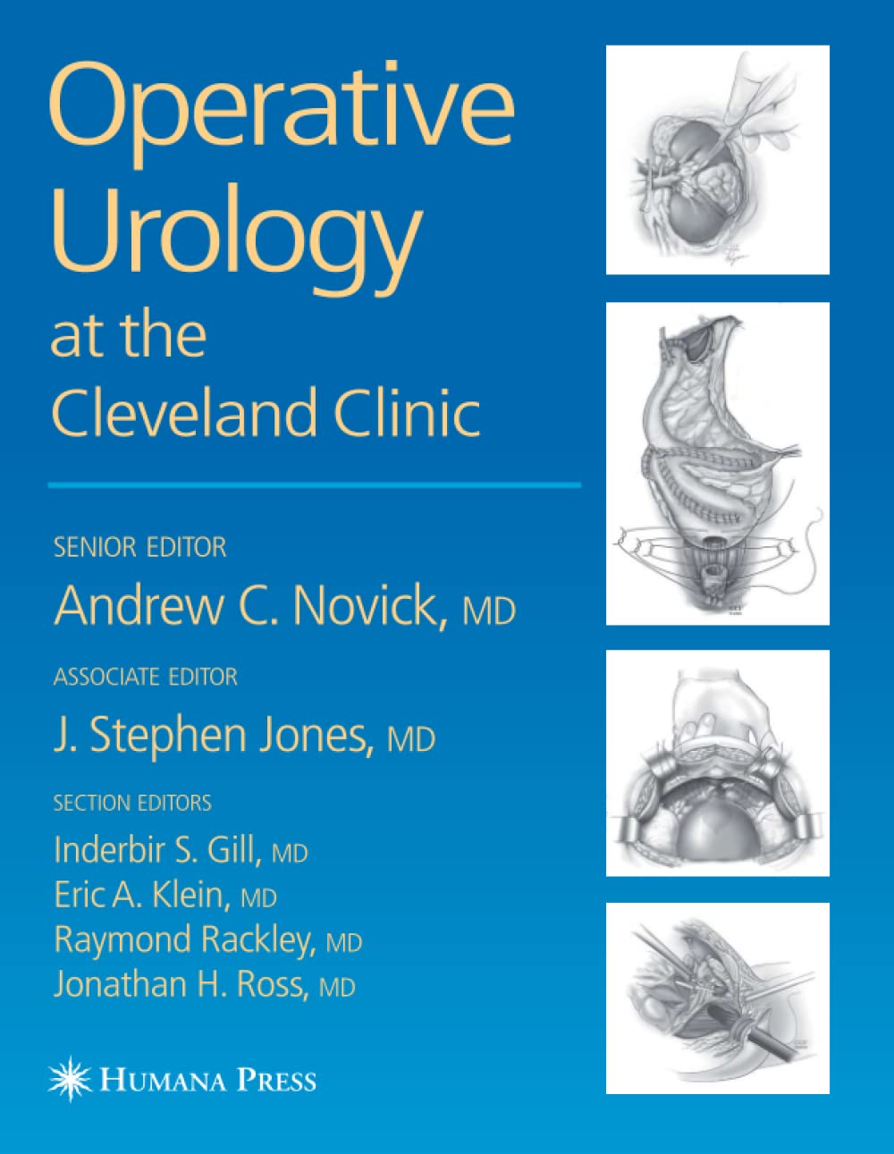 Operative Urology