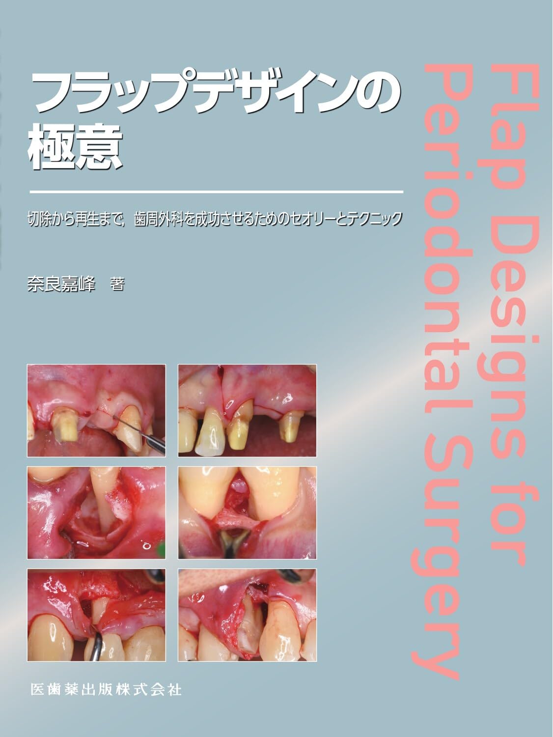【裁断済】フラップデザインの極意 : 切除から再生まで,歯周外科を成功 フラップデザインの極意: 切除から再生まで,歯周外科を成功させるため