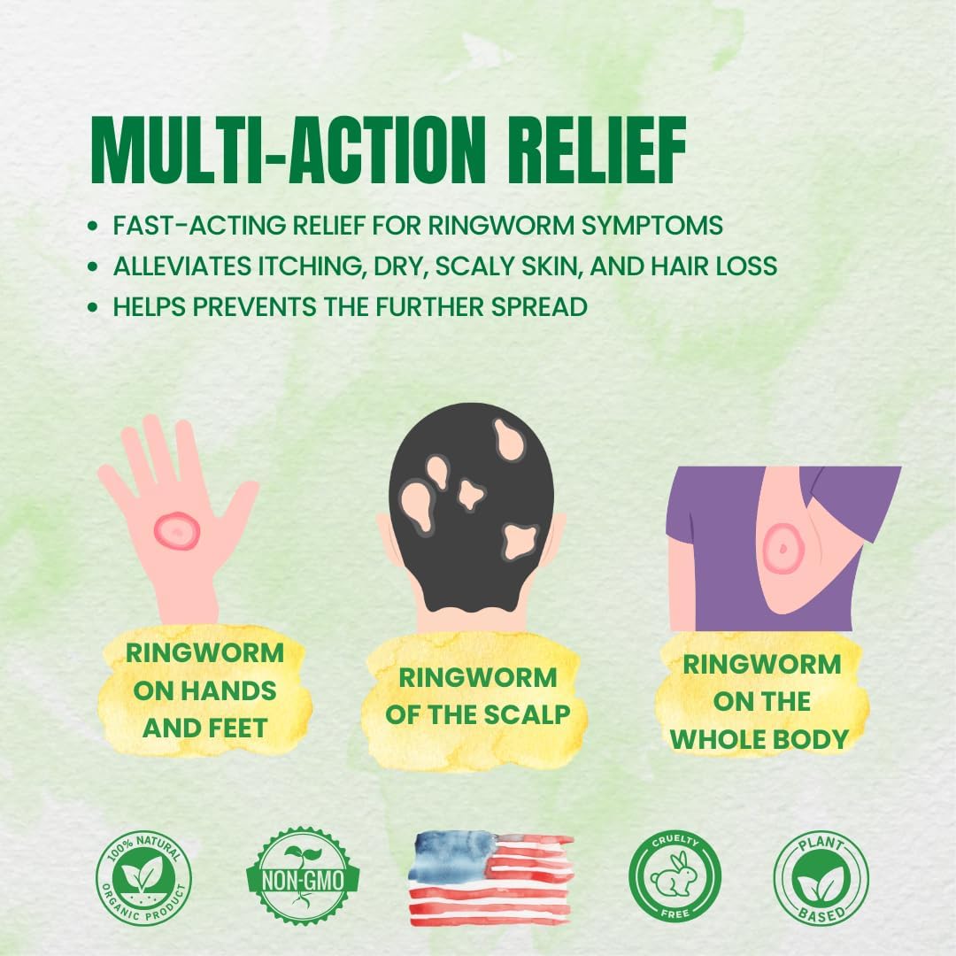 Forces of Nature Ringworm Treatment for Humans, Organic Homeopathic Medicine, 0.37 Fl Oz, Antifungal Multi Symptom Relief from Itchy, Red & Irritated Skin Associated with Ringworm, Non GMO - Image 2