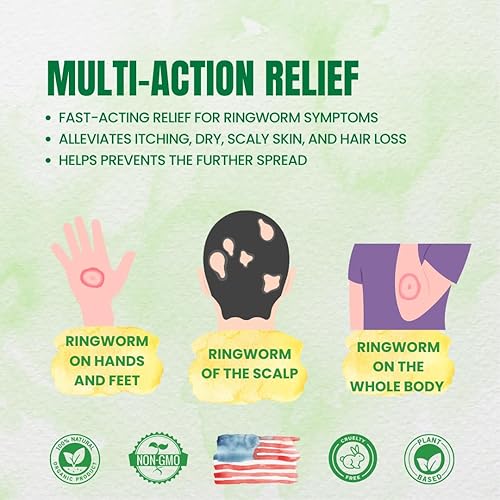 Miniatura 2 de Forces of Nature - Tratamiento natural y orgánico de tiña (0.4 fl oz), sin OMG, sin productos químicos nocivos, no tóxico, antifúngico de acción