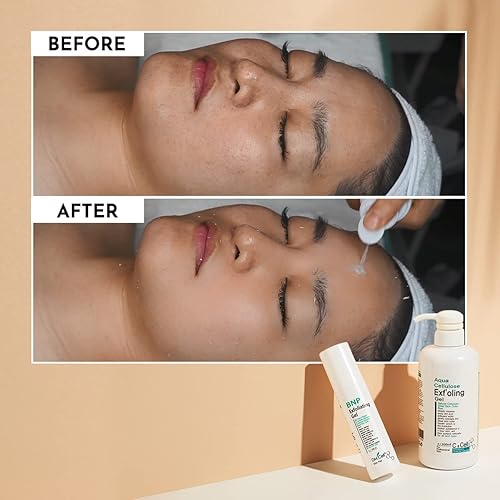 Miniatura 7 de DM.Cell - Limpiador facial suave Aqua Gommage | Gel exfoliante para pelar | Extractos naturales | Puntos negros, poros agrandados | Hidratante