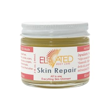 ELEVATED Skin Repair Balm All Natural & Organic Herbal All Purpose Skin Salve with Calendula & Wild Devils Club Soothe and Moisturize 2oz Glass Jar