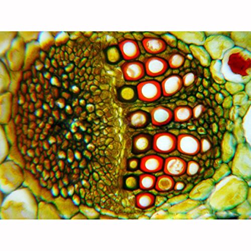 Amscope Ps50A Prepared Microscope Slide Set For Basic Biological Science Education, 50 Biology And Pathology Slides, Includes Fitted Wooden Case #TOP1