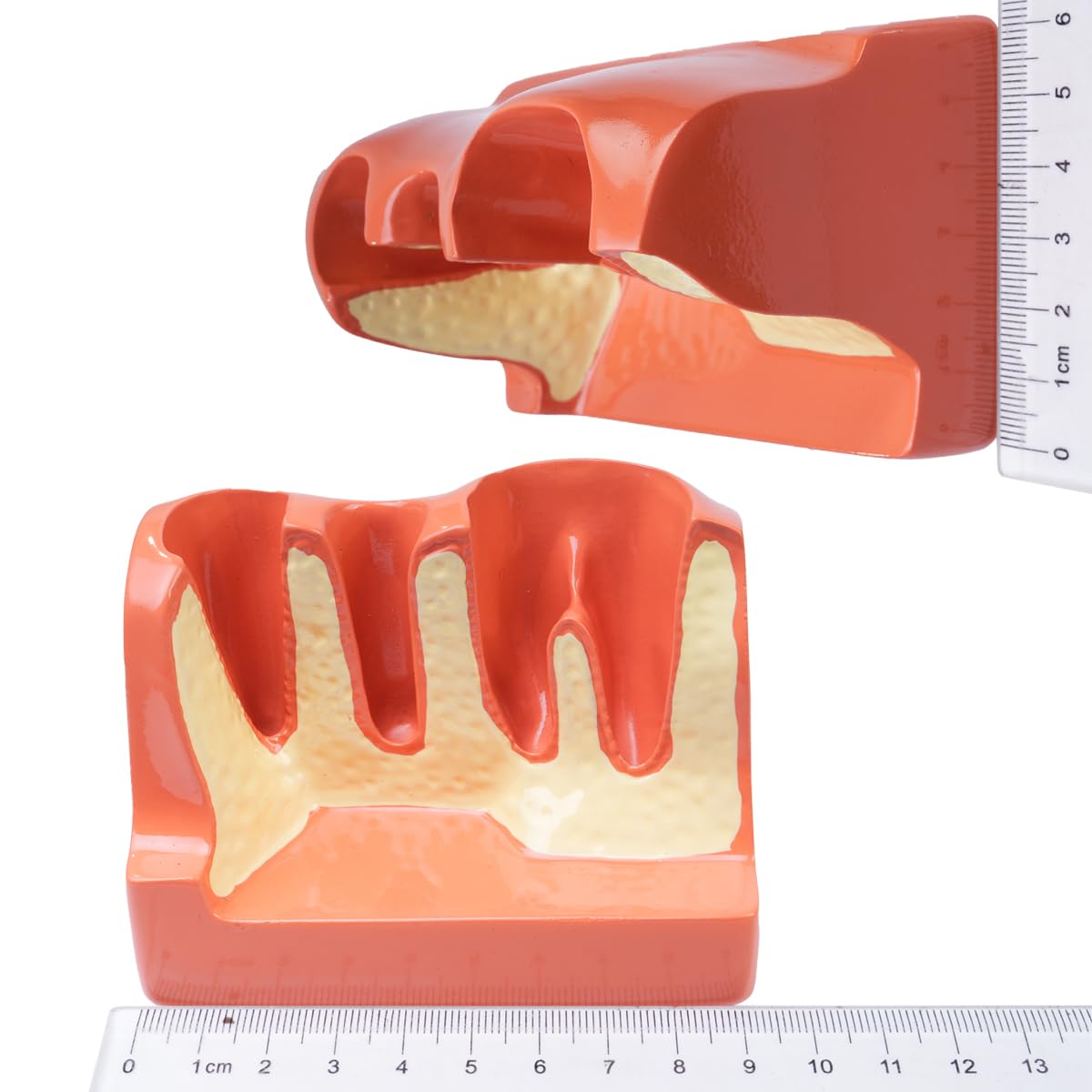Sarini Modelo de Diente Oral, Modelo de implante Dental con Corona y Puente extraíbles para demostración y formación