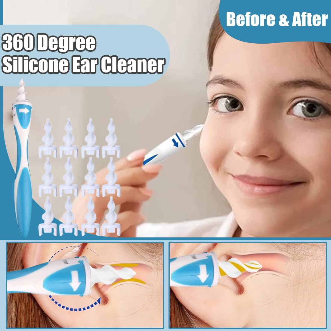 Pulisci Orecchie a Spirale in Silicone, Rimuovi Cerume in Modo Sicuro e Delicato, Kit per Pulizia Orecchie con 1 Impugnatura e 16 Punte Lavabili, Ideale per Adulti e Bambini (Confezione Singola)