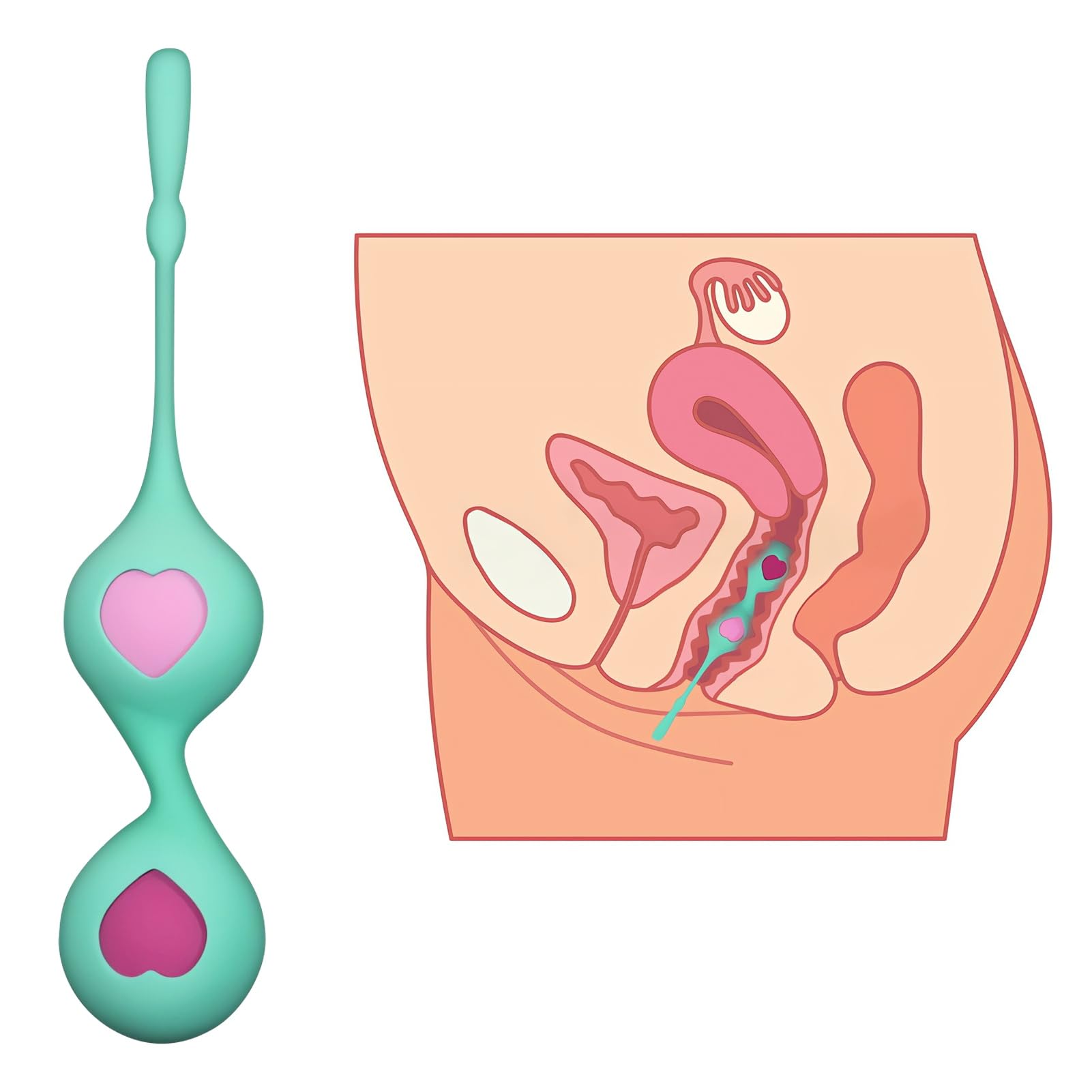 SXOVO Palline Vaginali - Palline di Kegel con Sfera Traballante Incorporata per Migliorare gli Esercizi di Kegel, 2 Manicotti in Silicone + 4 Kegel Balls Donna Intercambiabili di Diverso Peso