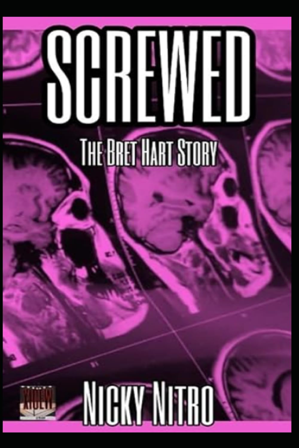 Screwed: The Bret Hart Story