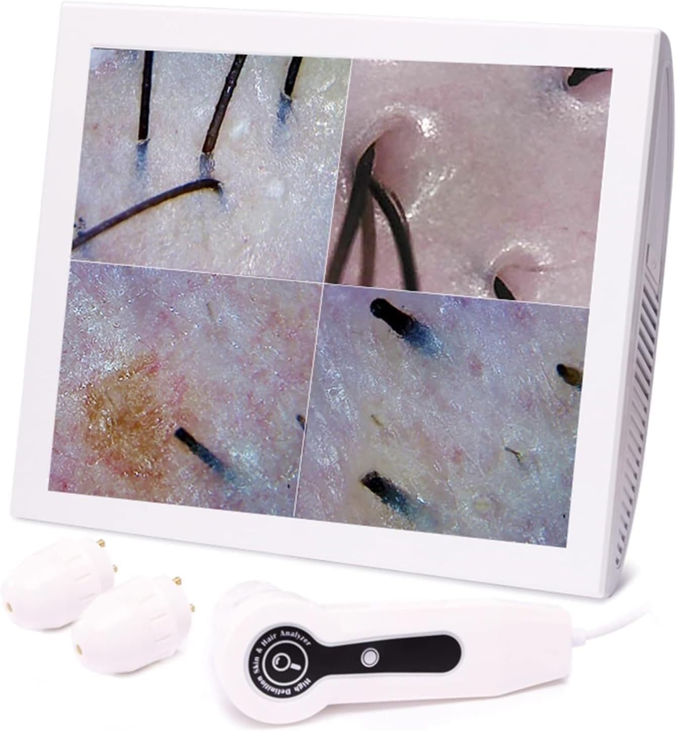 GTHTUHFD Scalp and Hair Follicle Analyser, 12 Inch HD Display, 50x/200x Magnification, 1000W Pixels, Trispectral Imaging, Skin Scalp Detector with UV Light Detection