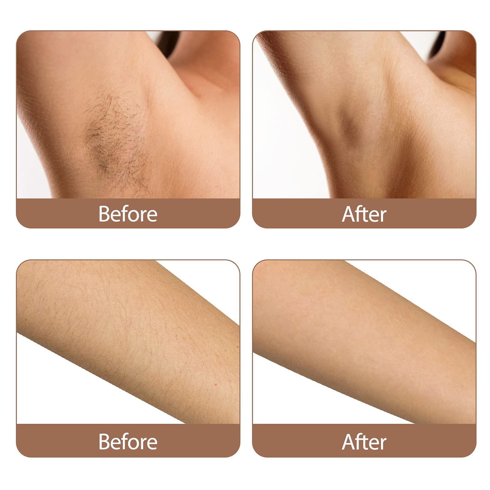 Yachyee Painless Laser Hair Removal Device for Women and Men Permanent