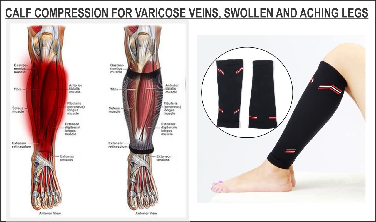 NEVER QUIT Calf Support Premium Leg Wrap Brace Compression Sleeve for Women Shin Splint Support Running Straps Sports | Gym | Running | Arthritis | Joint Pain Relief for Men and Women NEVER QUIT Calf Support Premium Leg Wrap Brace Compression Sleeve for Women Shin Splint Support Running Straps Sports | Gym | Running | Arthritis | Joint Pain Relief for Men and Women