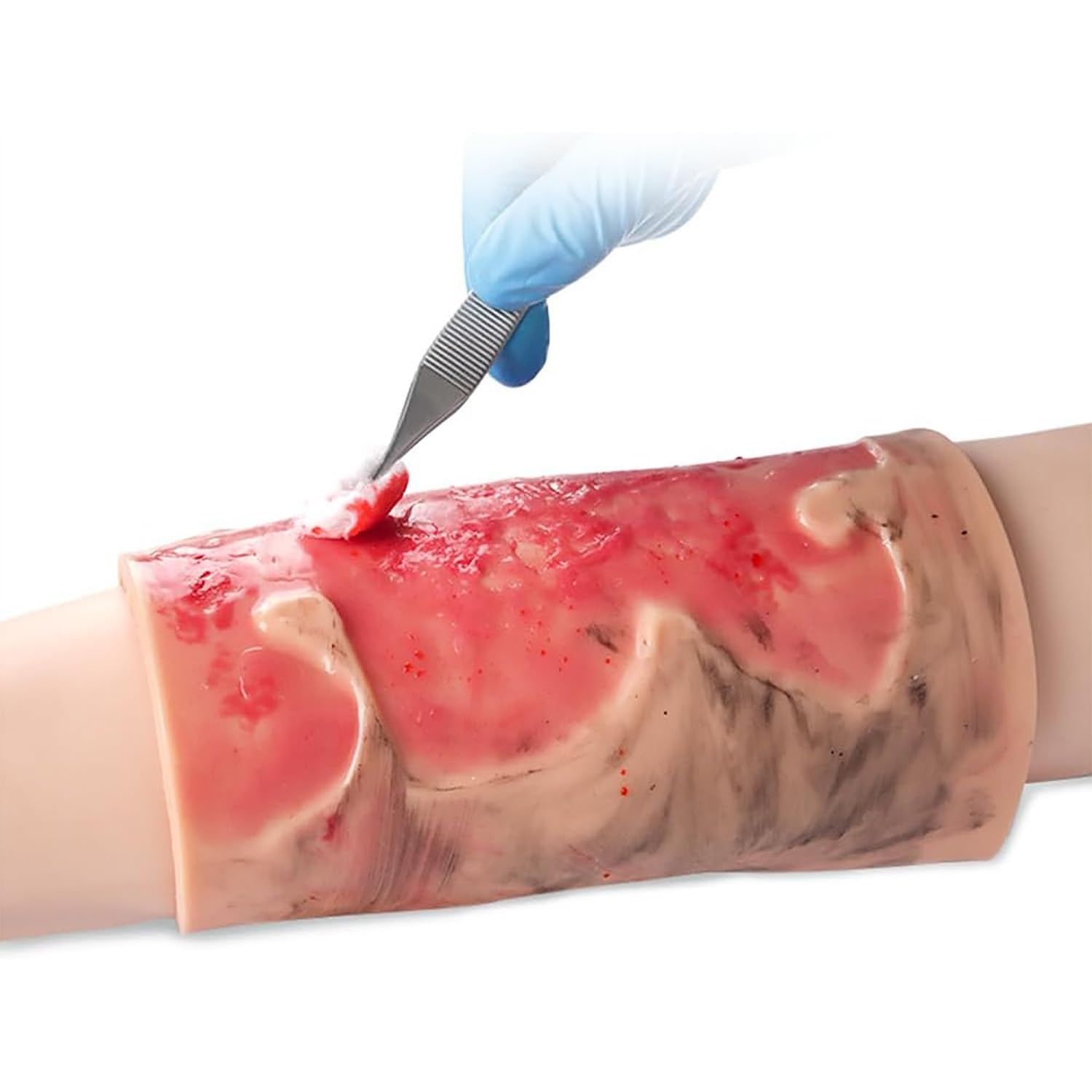 ERICAT Simulated Burn Wound Model, 2-3 Degree Wound Care Wound Models, Realistic Appearance Design and Rapidly Improve Skills, Wearable Design and Reusabilit Use, for Teaching and Learning