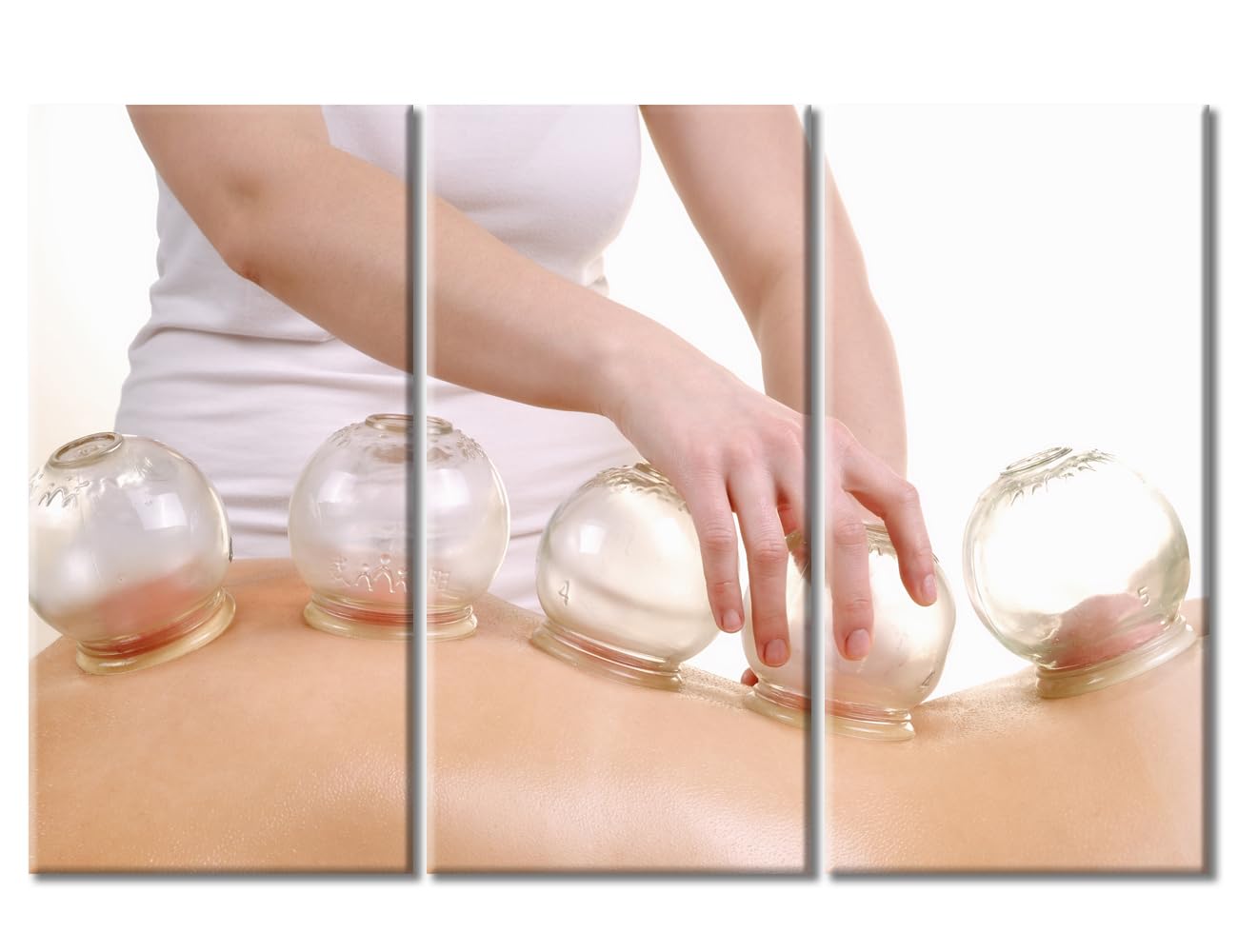 Cupping Massage Wall Art Traditional Chinese Cupping Therapy Posters Wall Art for Living Nosocomium 3 Panels Art Prints Giclee Wooden Framed Gallery-Wrapped Ready to Hang (60" Wx40 H)