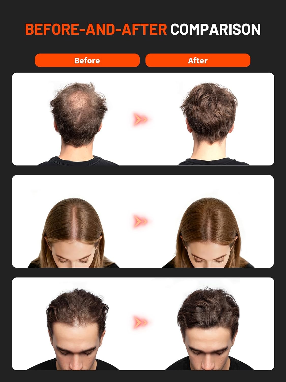 Red Light Hair Growth Cap, Red Light Cap - Image 3