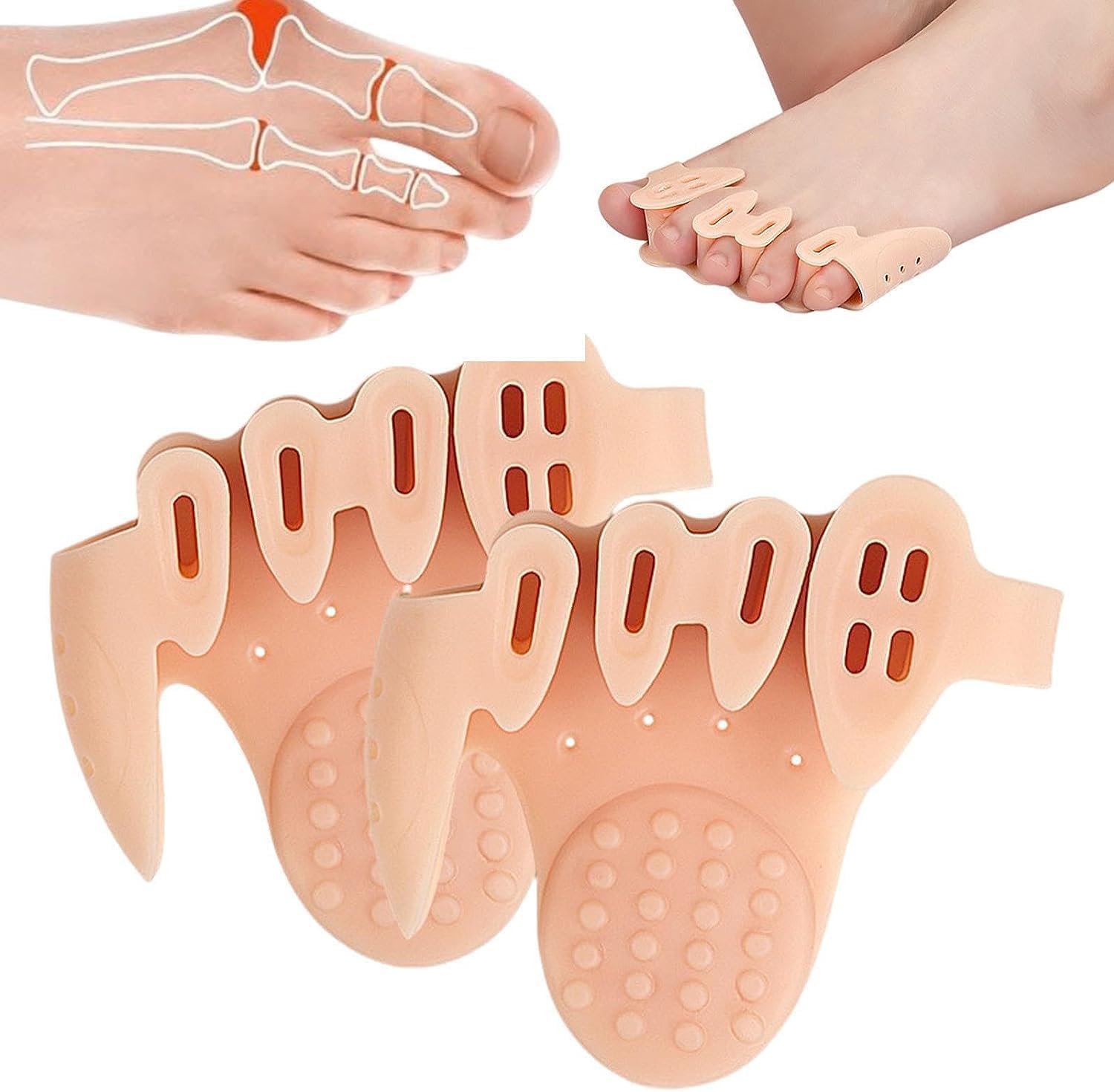 2 Pairs Toe Splitter, 5-hole Toe Stretcher, Soft Gel Toe Spacers to Correct Toes, Toe Corrector, Bunion Corrector Toe Stretcher Big Toe Separators (Colour of skin, One size)