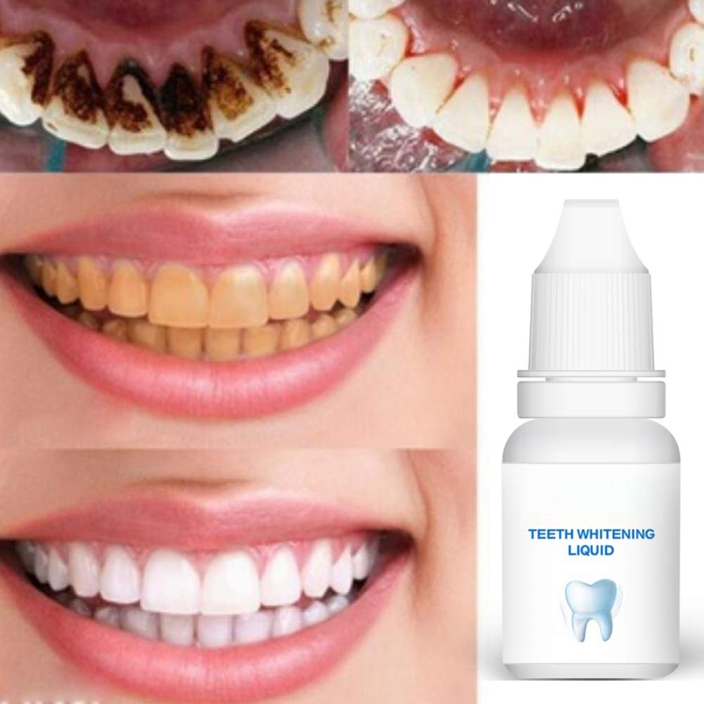 Blanchiment des Dents Essence et Sérum, Gel de Blanchiment des Dents Pour  Nettoyer les Dents Blanchissant