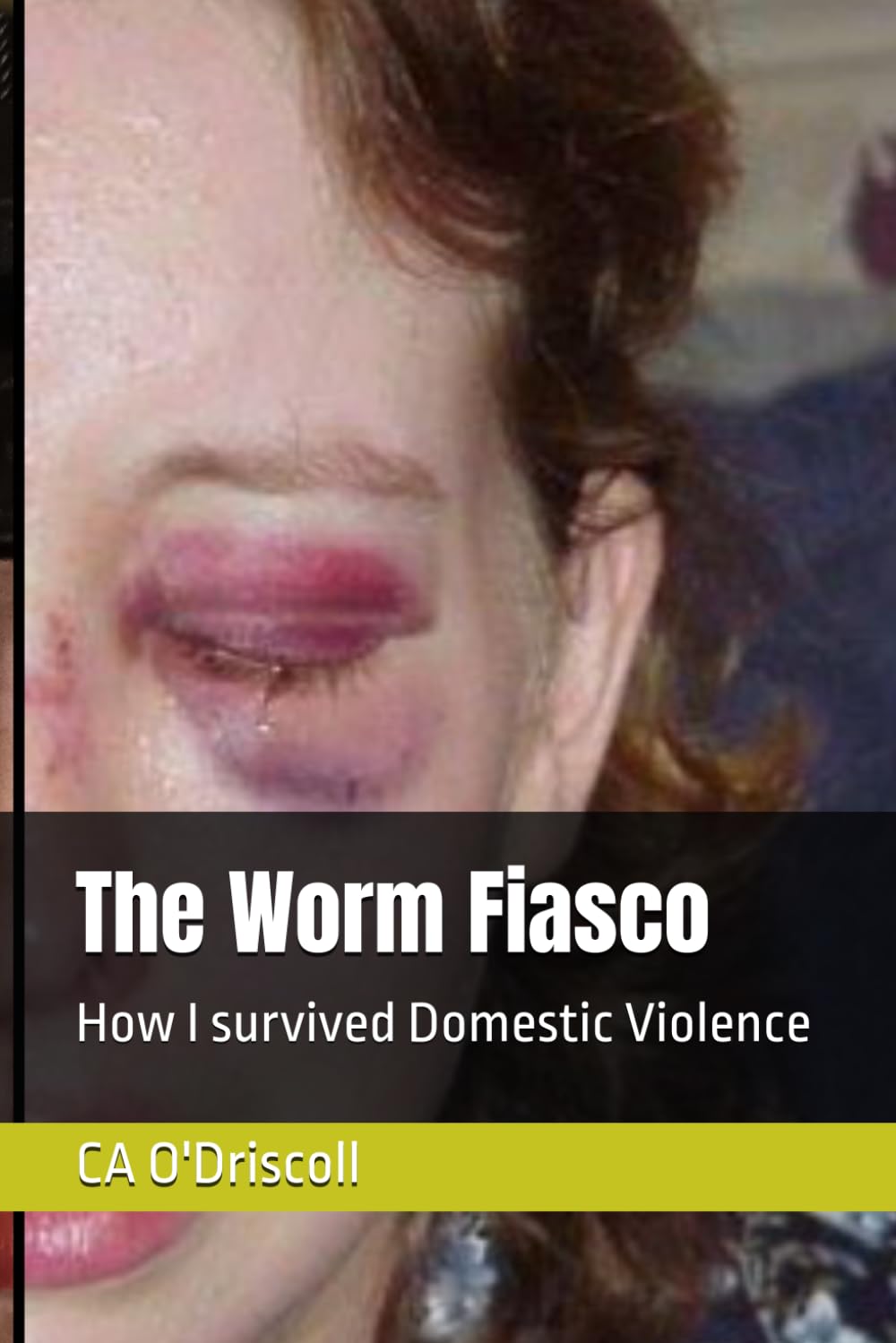 The Worm Fiasco: How I Survived Domestic Violence