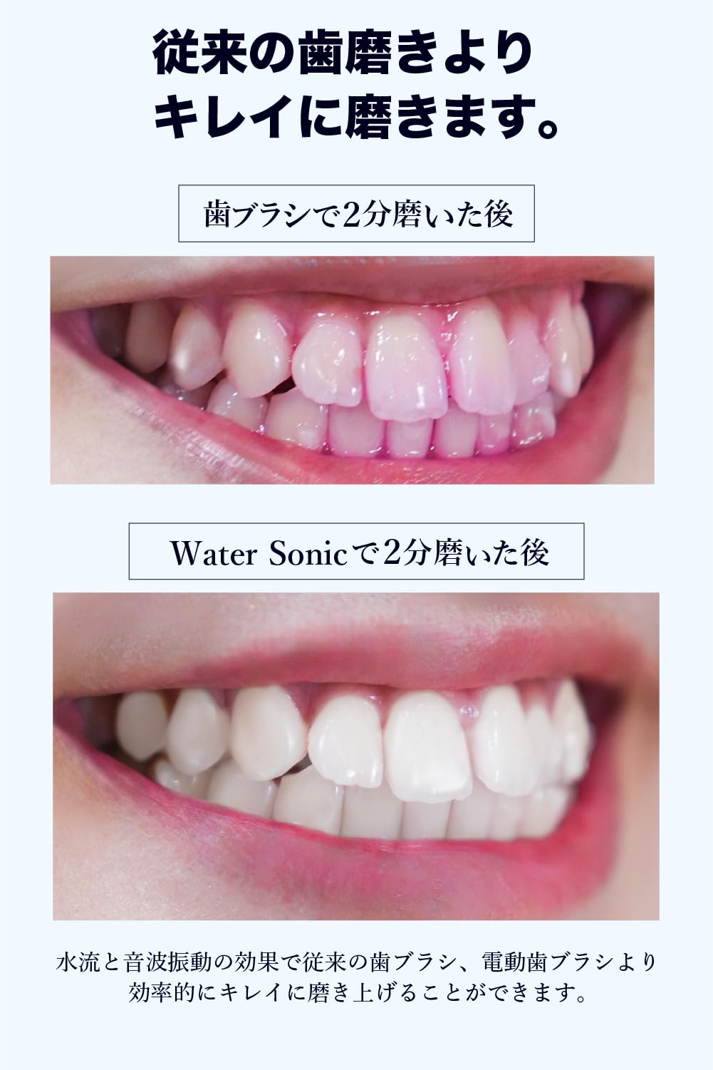 Water Sonic ジェットウォッシャー一体型電動歯ブラシ 口腔洗浄器 Water Sonic ジェットウォッシャー一体型電動歯ブラシ 口腔洗浄