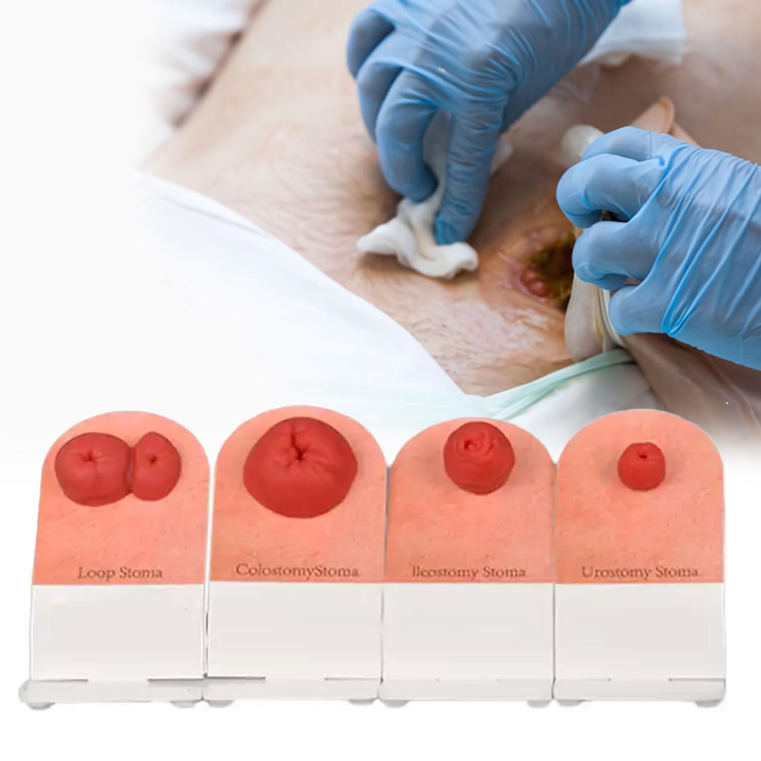 JOSBY 4pcs Ostomy Care Training Kit, Stoma Models for Medical Education, Tabletop Simulation Fecal Ostomy Model, Wound Care Models, Ostomy Practice Model, for First-aid Course, Teaching Demonstration