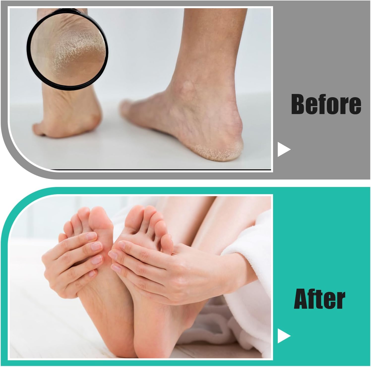 Professional Foot Rasp Callus Remover Set - 2 Stainless Steel Pedicure Files with 12 Replacement Blades (Coarse & Fine Grit) for Dead Skin Removal, Home Salon Foot Care