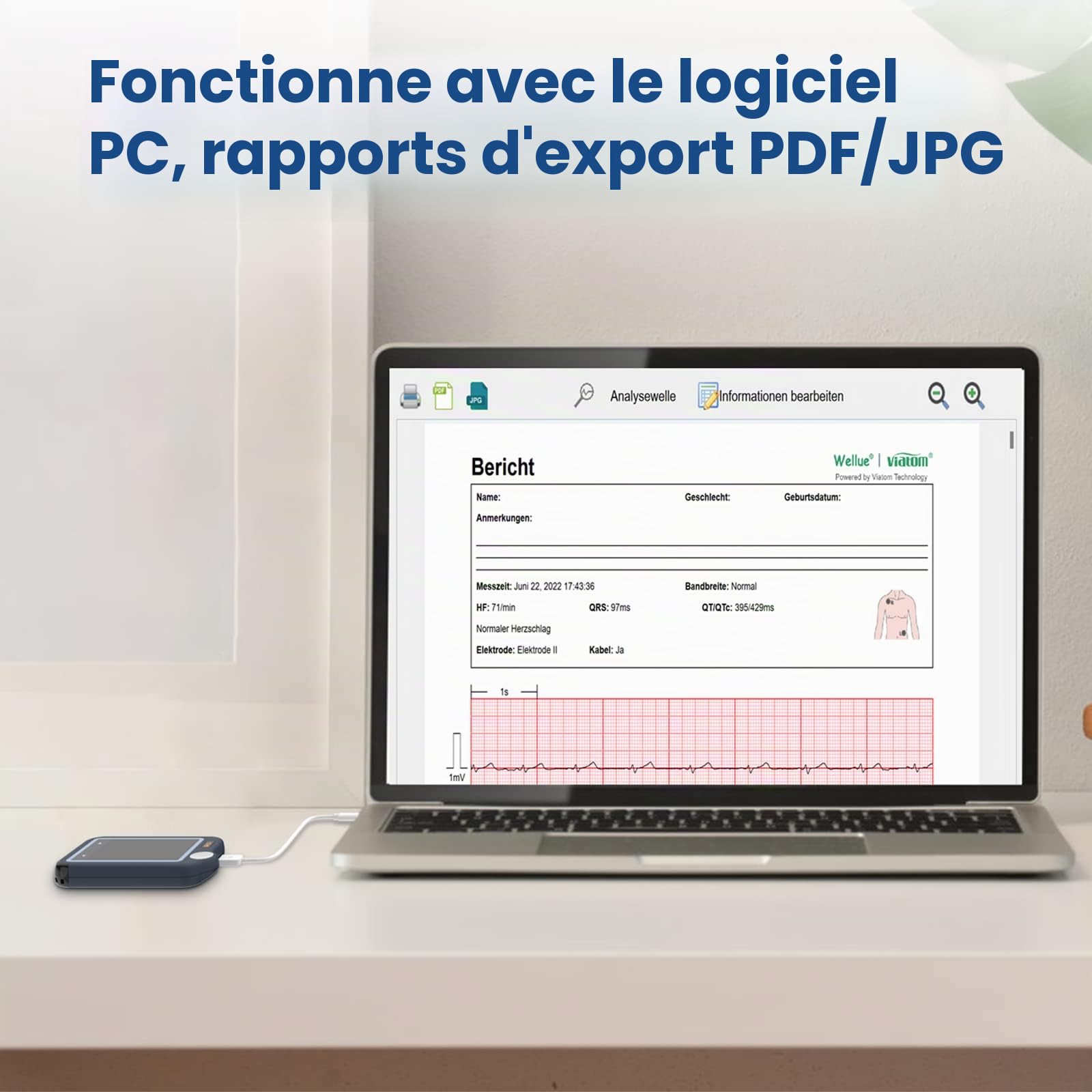 Wellue Pulsebit EX ECG Monitor, appareil ECG Bluetooth avec application iOS et Android, enregistrement 30s / 60s / 5min, fonctionne avec smartphone et PC, traceur de santé cardiaque portable personnel