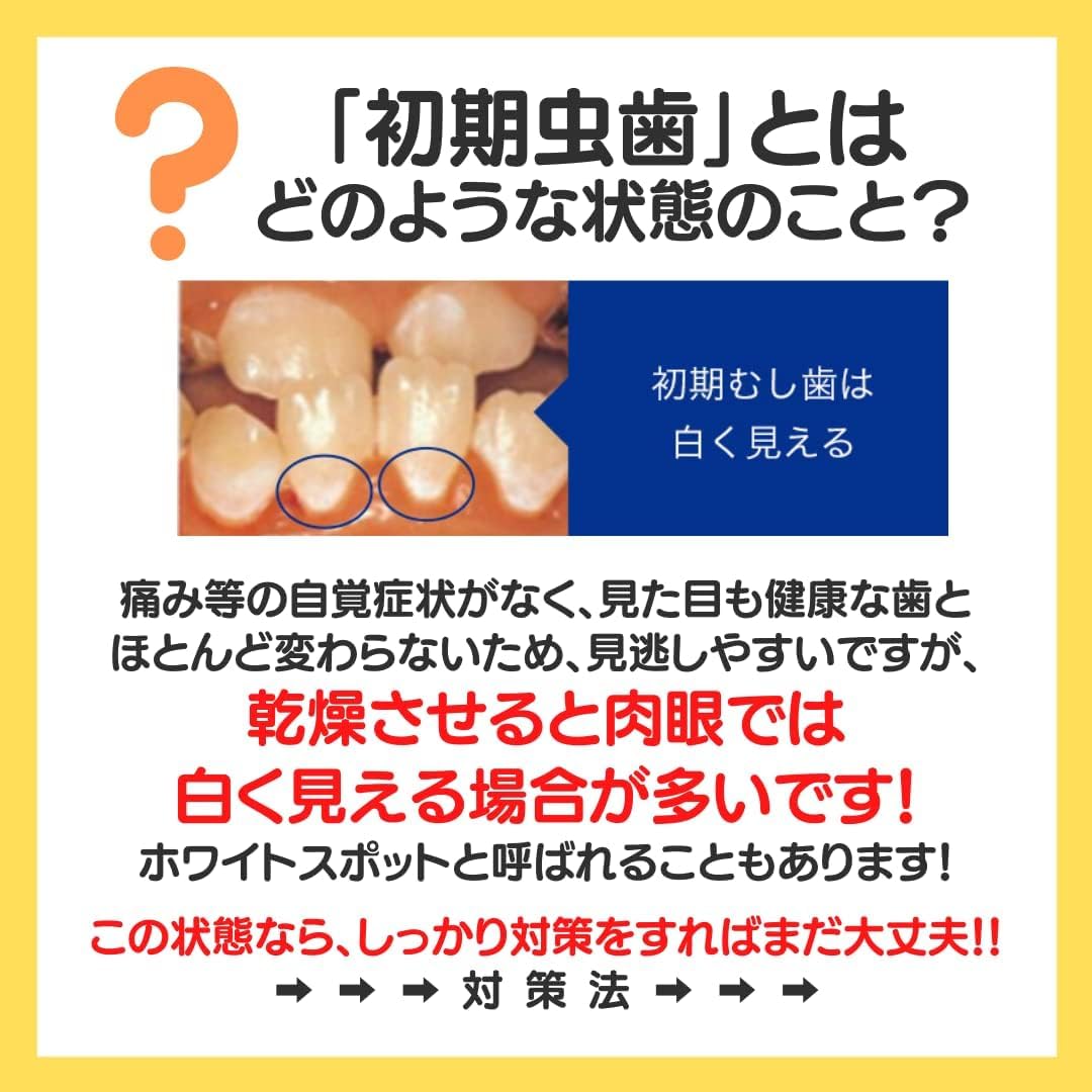 未使用 3本セット ホワイトニングペースト スマイルコスメティック フッ素配合 Amazon | スマイルコスメティック ホワイトニングペースト 85ml × 3本