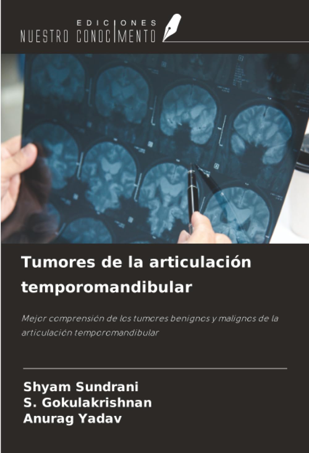 Tumores de la articulación temporomandibular: Mejor comprensión de los tumores benignos y malignos de la articulación temporomandibular