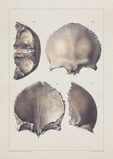 Anatomy SKULL CRANIAL BONE print SRA3 12x18 conqueror laid paper