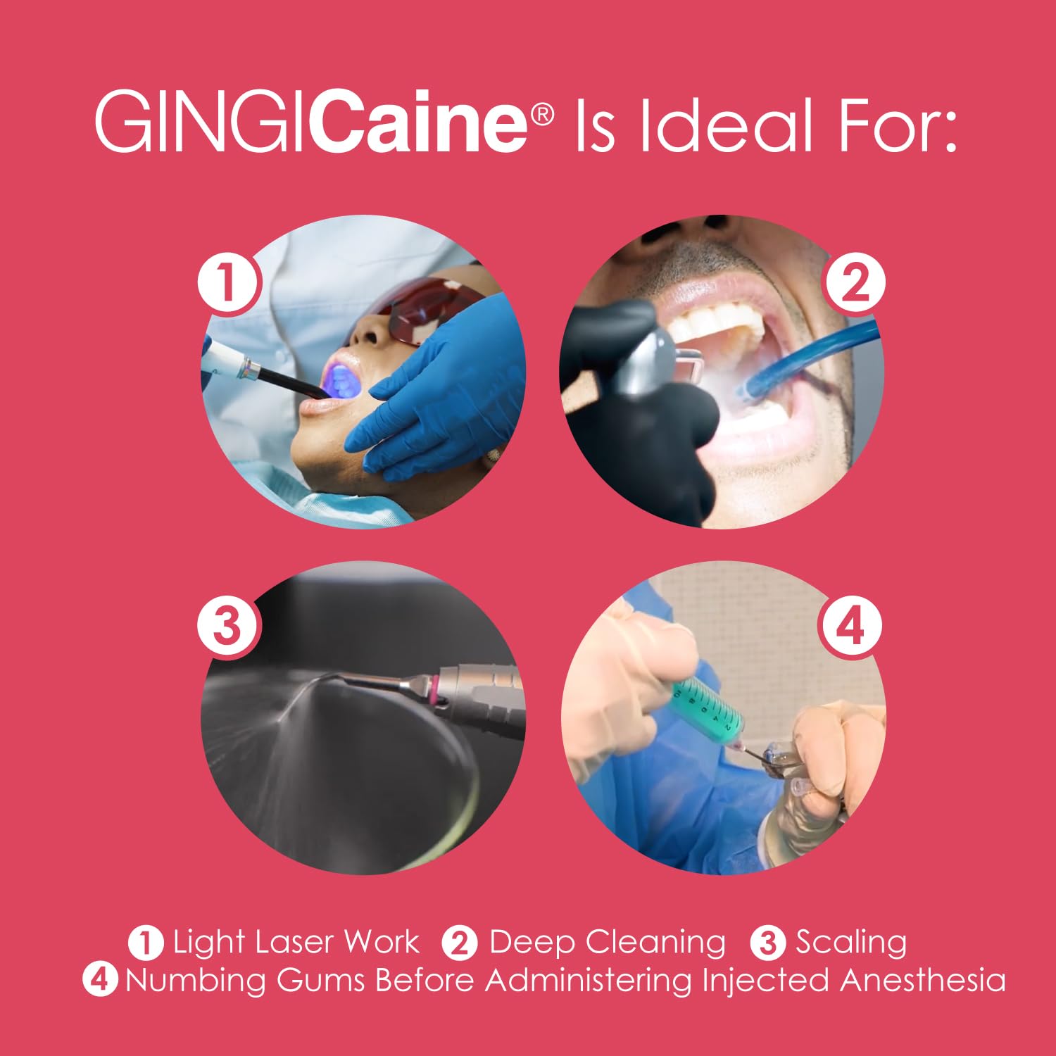 Oral Anesthetic Gel in Syringe by GINGICaine, 1.2ml Strawberry Flavored Oral Anesthetic Gel for Smooth Local Anesthetic Application