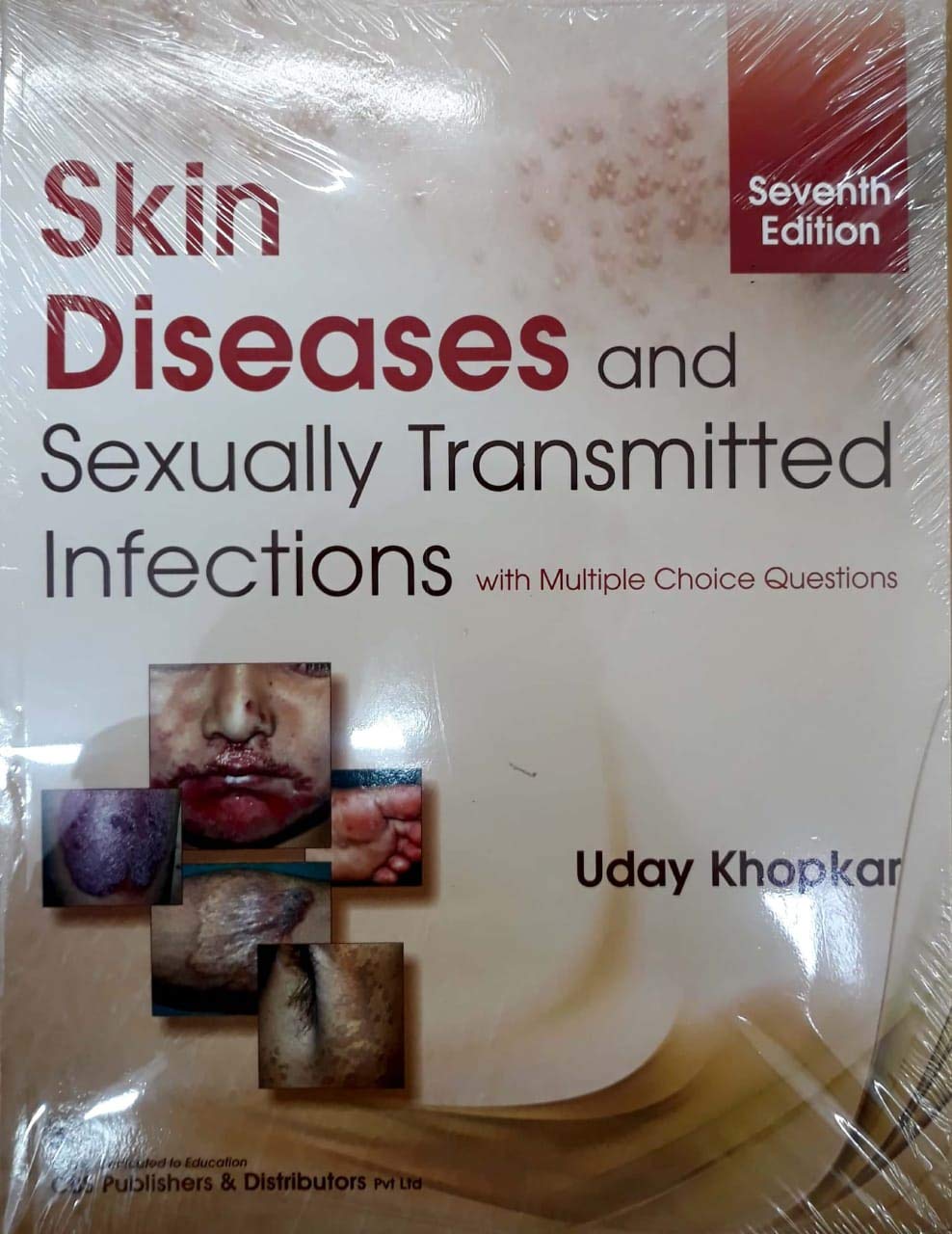 SKIN DISEASES AND SEXUALLY TRANSMITTED INFECTIONS 7ED (PB 2023)