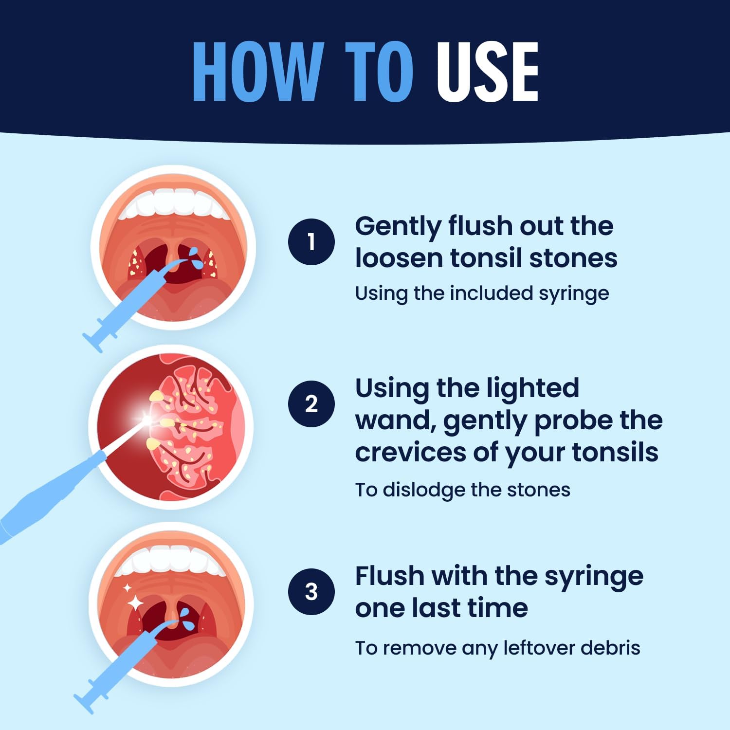  Frederick’s  Easy Tonsil Stone Remover Kit - Fast Painless Tonsillolith Removal Tool - Fight Bad Breath - Pick and Oral Irrigator - 8 Pieces thumbnail