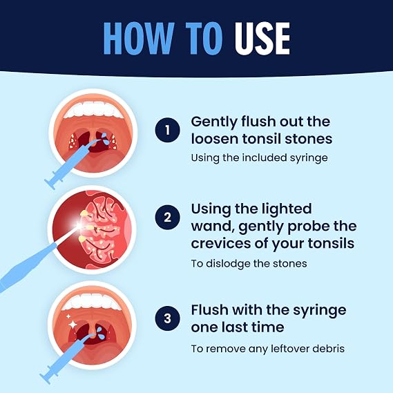 Dr. Fredericks Original Easy Tonsil Stone Remover Kit - Fast Painless Tonsillolith Removal Tool - Fight Bad Breath - Pick and Oral Irrigator - 8 Pieces