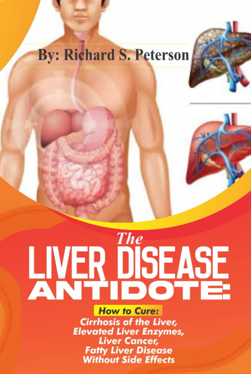 THE LIVER DISEASE ANTIDOTE How to Cure Cirrhosis of the Liver