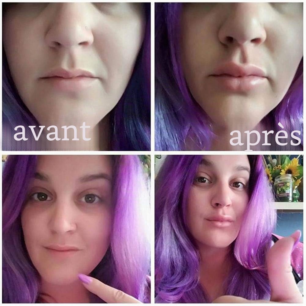 Sonew Outils D'augmentation Des Lèvres, L'outil de Beauté pour Appareil de Beauté Des Lèvres En Forme de Poisson Portable Rend Votre Lèvre Plus Pleine