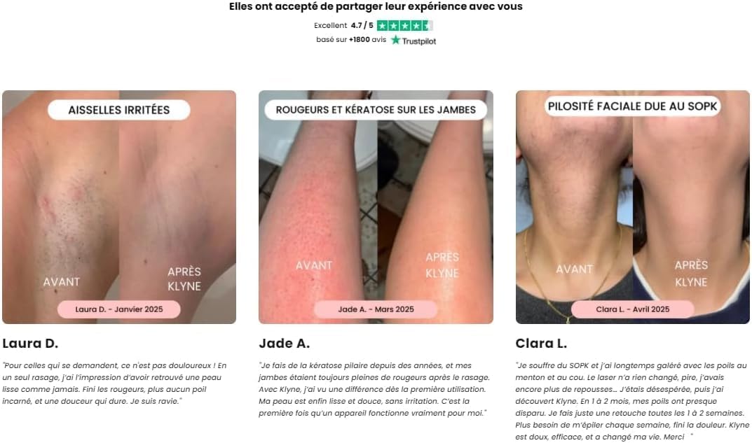Rasoir Klyne Femme,2026 Nouveau Klyne Tondeuse À Double Tête Femme,Tondeuse Intime & Sourcils,Étanche Ipx7,Recharge Usb,Pour Jambes,Aisselles.Bikini Et Nez (Rose)
