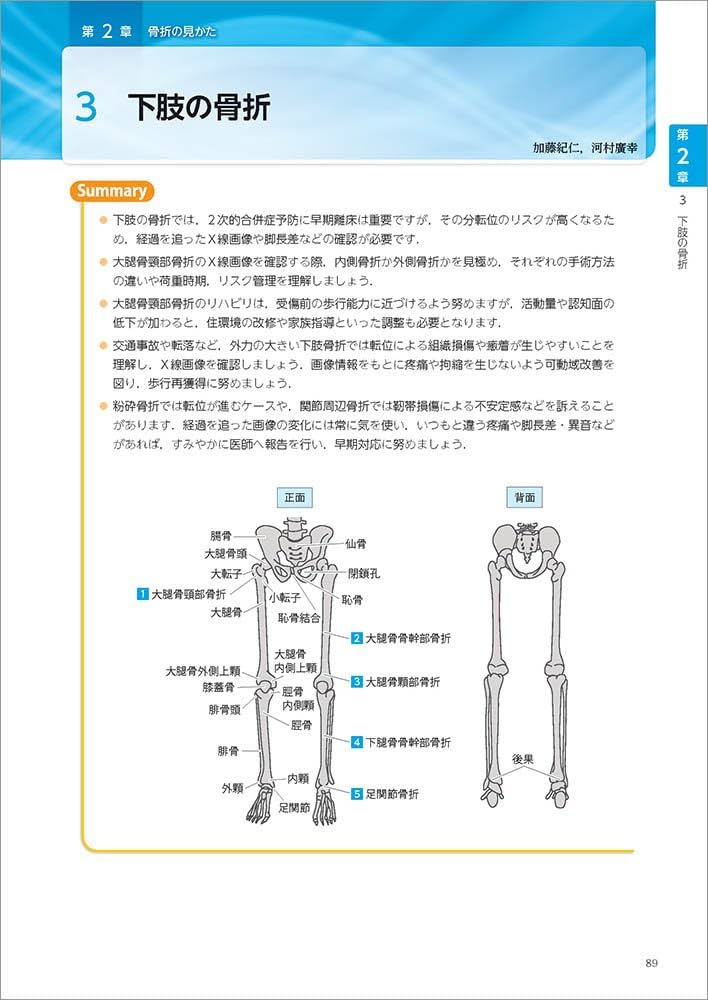 運動器X線画像の見方　ジャパンライム 61EHIfe+TvL._AC_UL210_SR210,