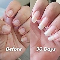 Vista 4 de Nailz Aplicador de bolígrafo para uñas y cutículas, aceite radiante para cutículas para fuerza y humedad, suero de rejuvenecimiento para cutículas