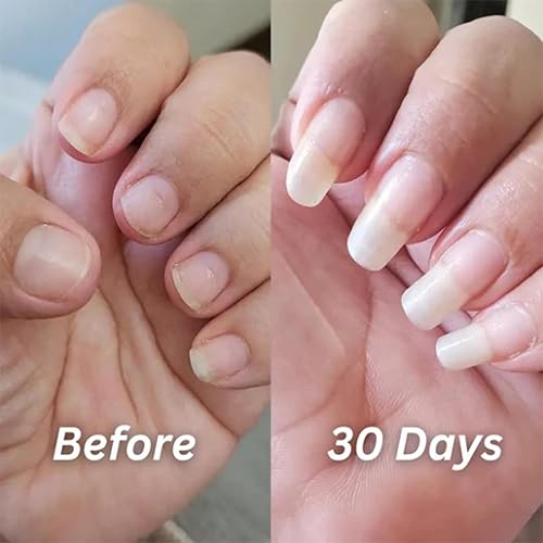 Miniatura 4 de Nailz Aplicador de bolígrafo para uñas y cutículas, aceite radiante para cutículas para fuerza y humedad, suero de rejuvenecimiento para cutículas,