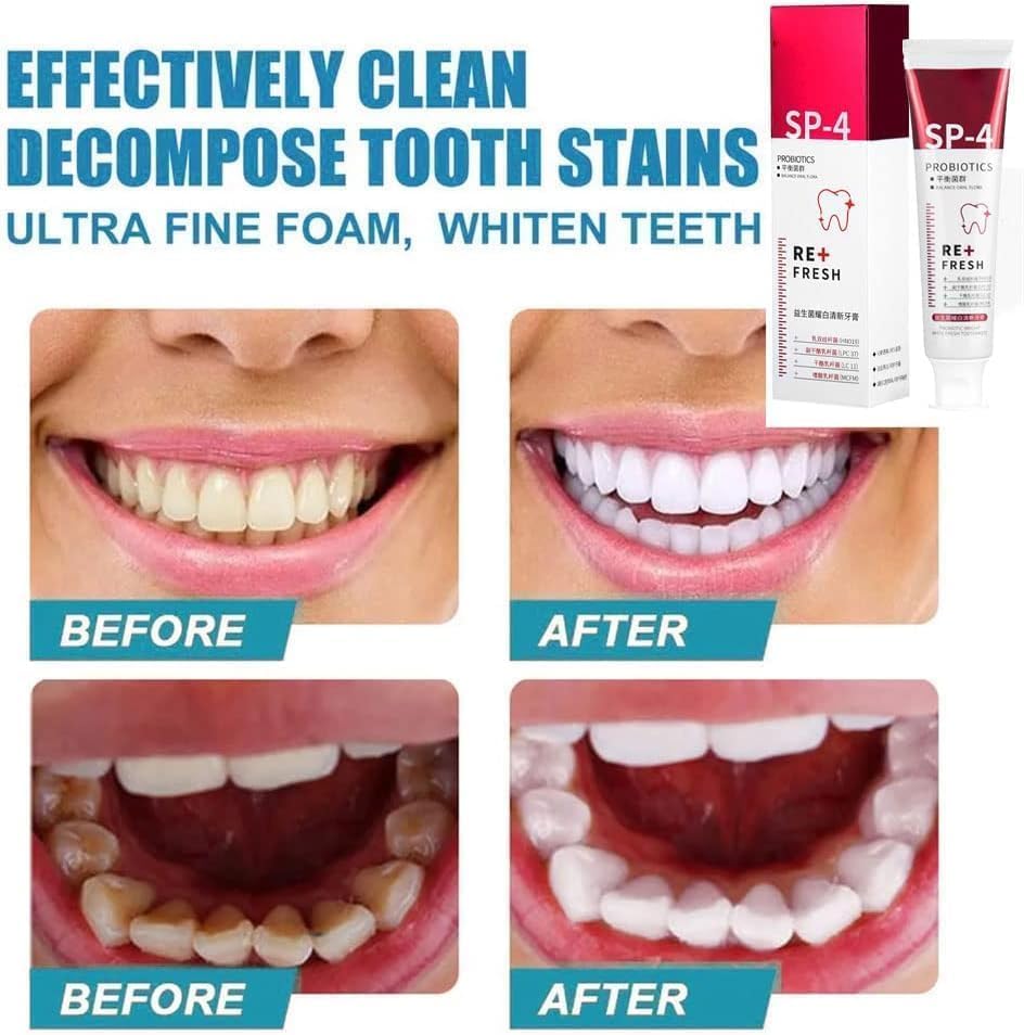 Miniatura 5 de Pasta de dientes blanqueadora SP-4 Probióticos, pasta de dientes Yayashi SP-4, pasta de dientes de aliento fresco, promueve dientes y encías