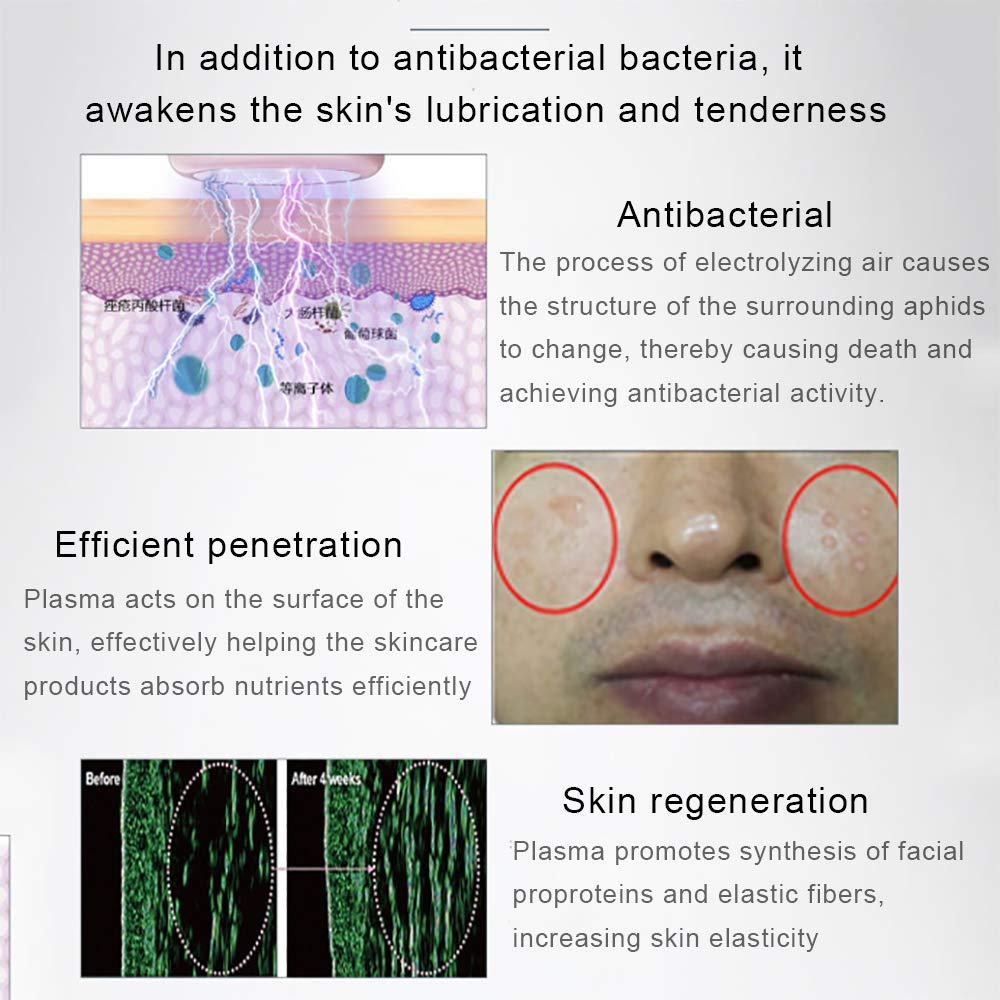 Strumento elettrico di bellezza, sterilizzazione per acne, rughe, plasma facciale antietà oltre allo strumento di bellezza per acari, altamente permeabile, nessuna radiazione non danneggia la pel