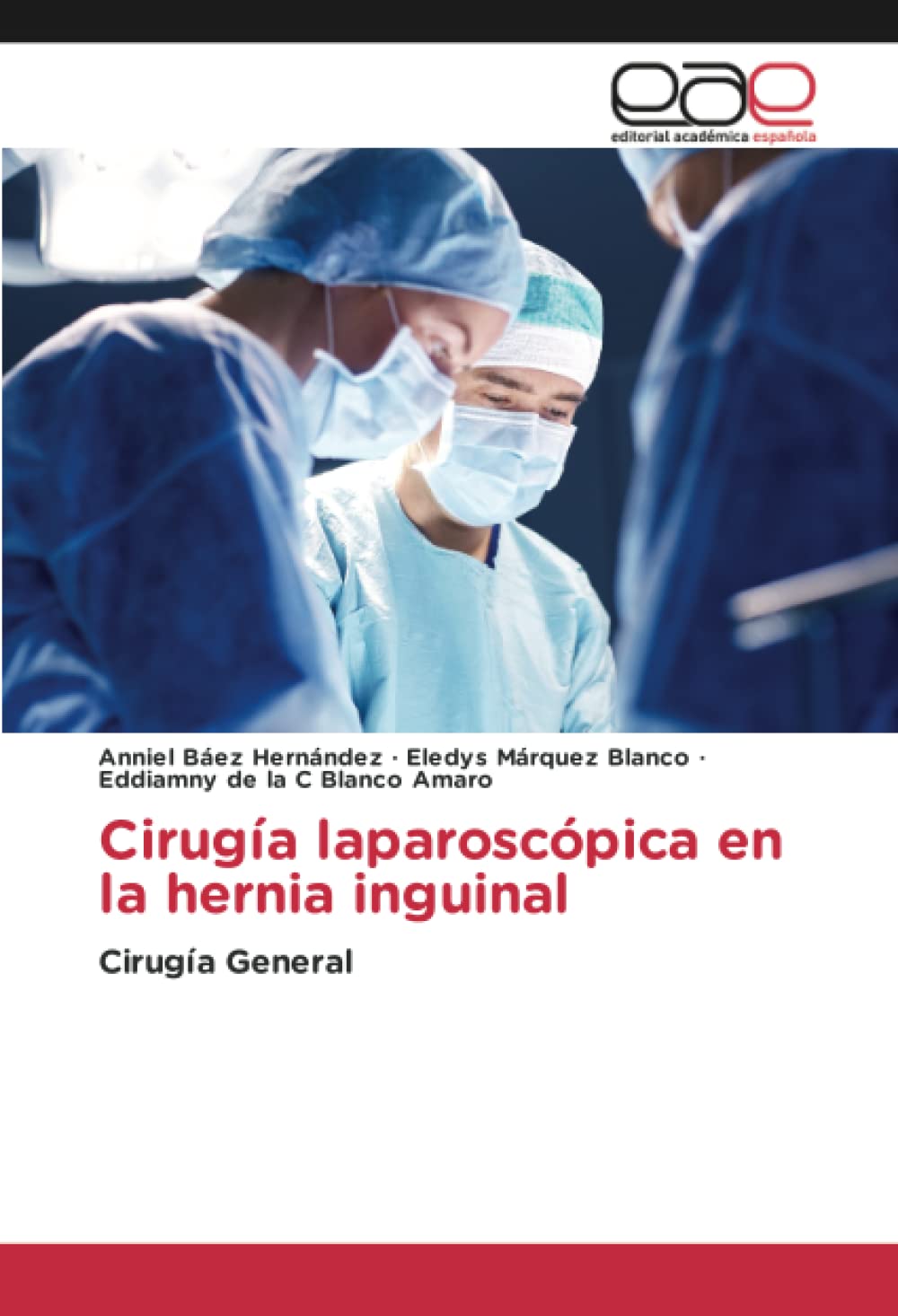Cirugía laparoscópica en la hernia inguinal: Cirugía General