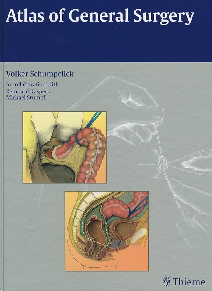 Atlas of General Surgery: 9783131440914: Medicine & Health